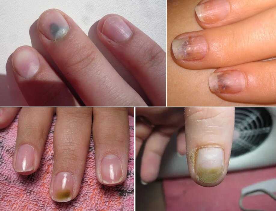 Подраздел 1.1: Что такое «голые ногти»